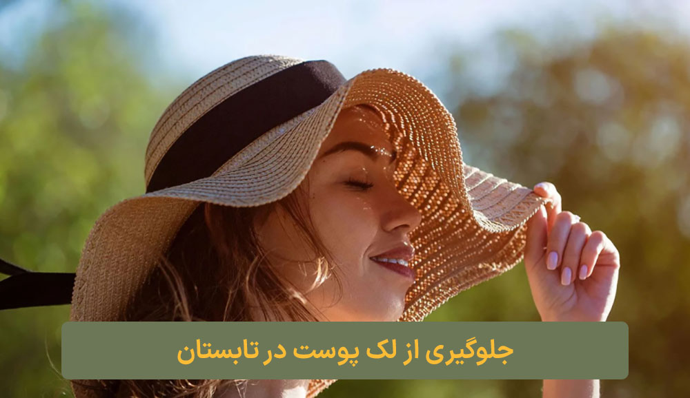 جلوگیری از لک پوست در تابستان ارایشی کلبه نیک