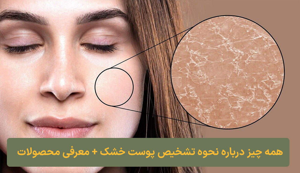 همه چیز درباره نحوه تشخیص پوست خشک + معرفی محصولات مفید ارایشی کلبه نیک